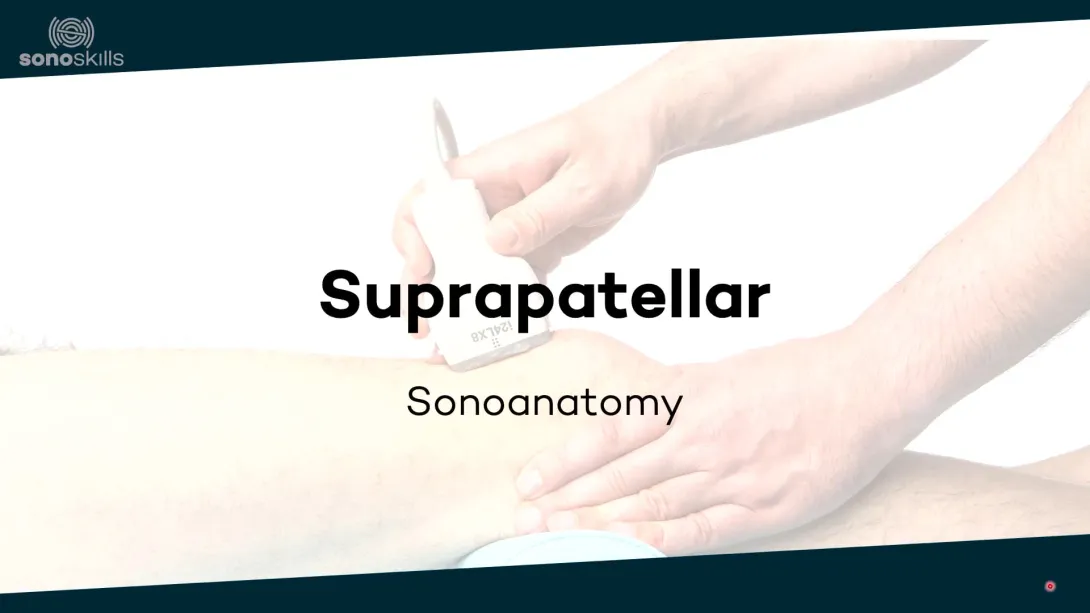 Suprapatellar - sonoanatomy