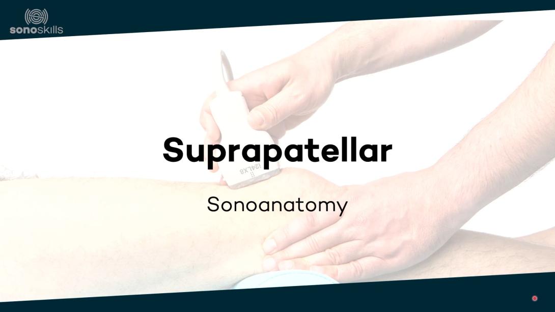 Suprapatellar - sonoanatomy
