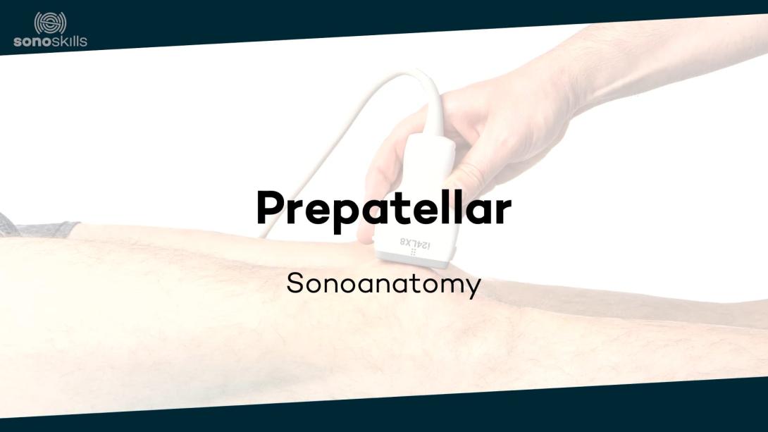 Prepatellar - sonoanatomy