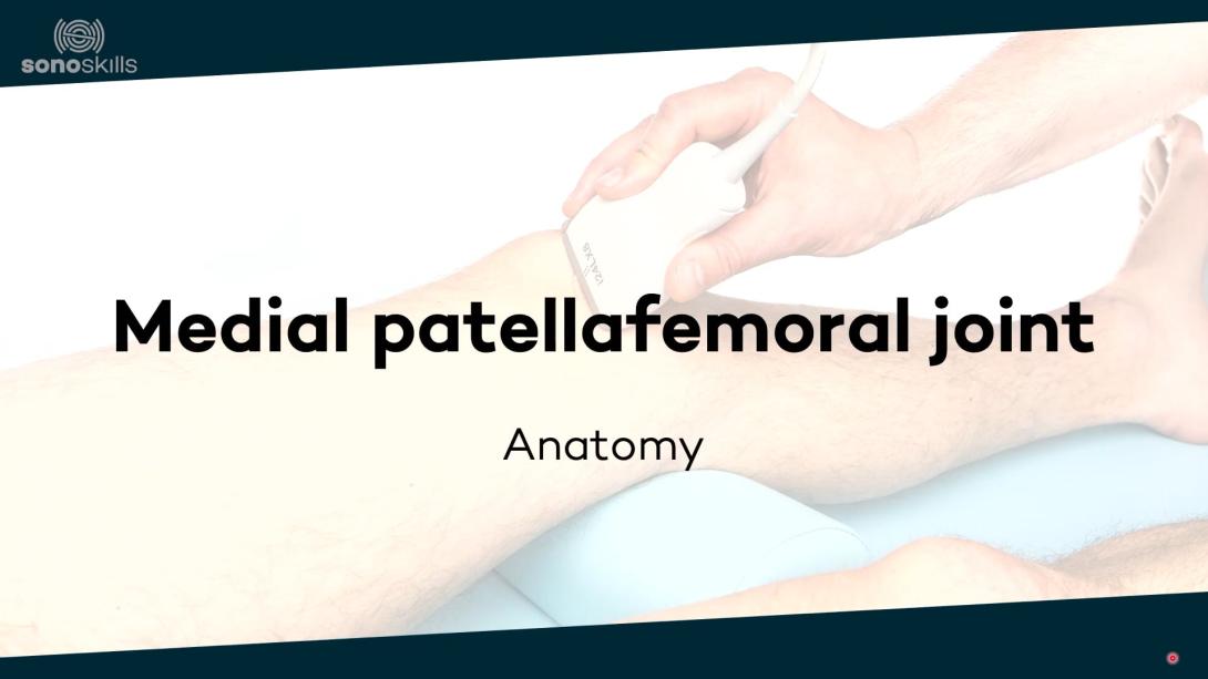 Medial patellofemoral joint - anatomy