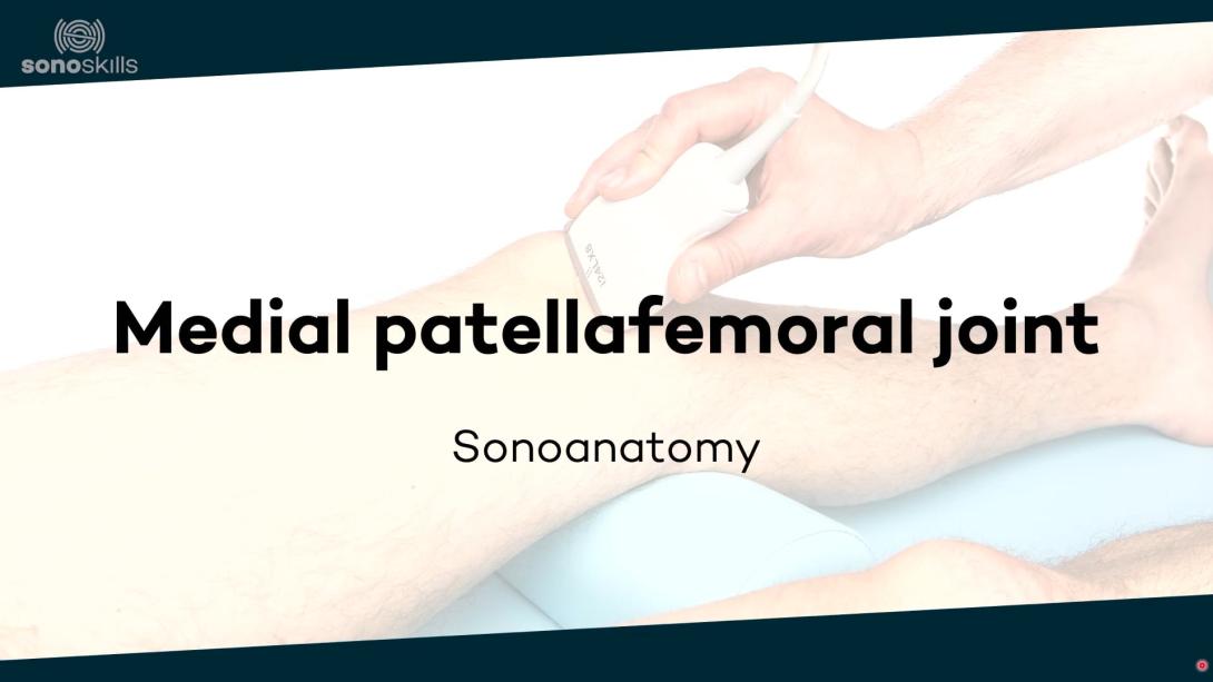 Medial patellofemoral joint - sonoanatomy