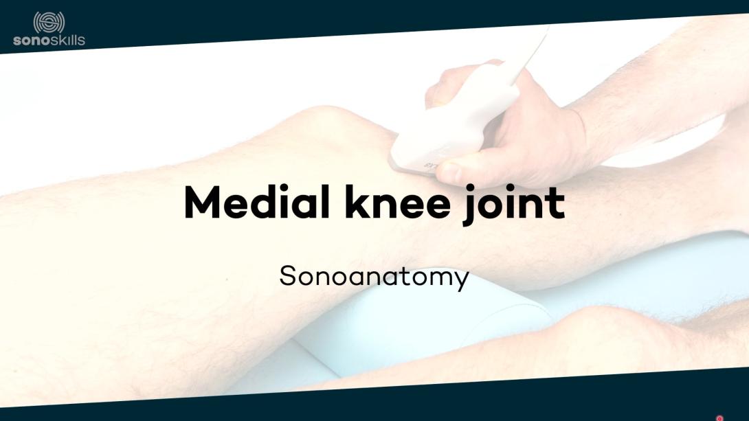 Medial knee joint - sonoanatomy
