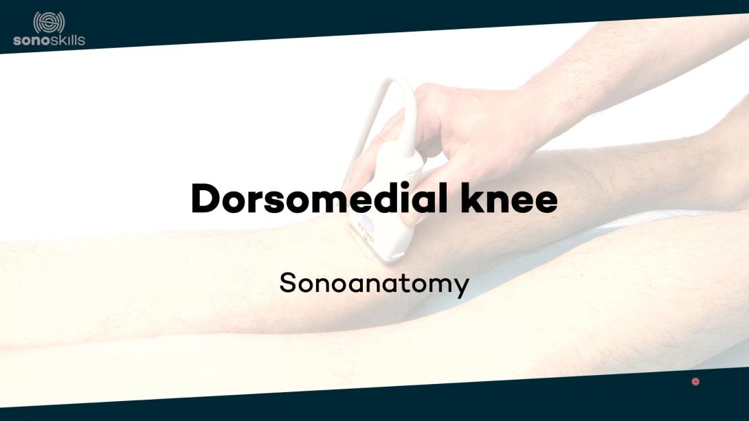 Dorsomedial knee - sonoanatomy