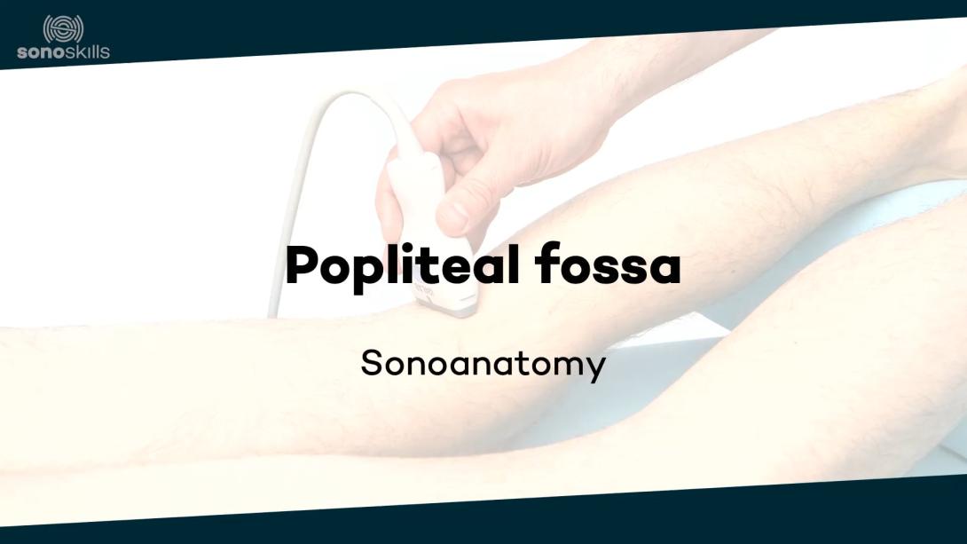 Popliteal fossa - sonoanatomy