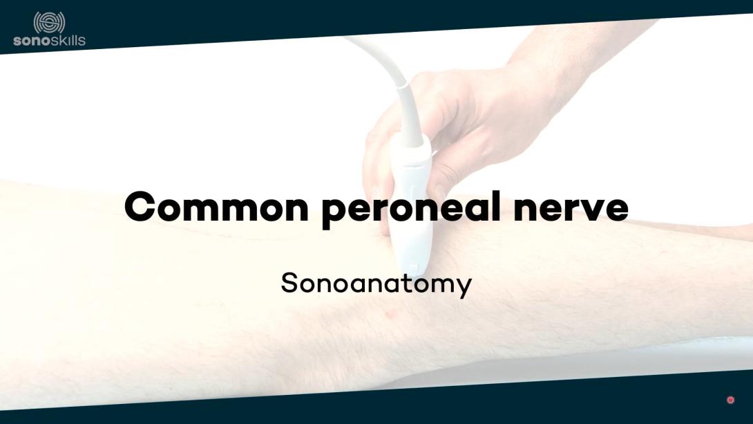 Common peroneal nerve - sonoanatomy