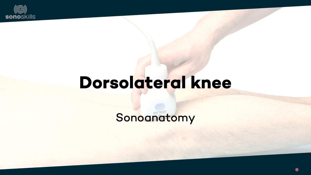 Dorsolateral knee - sonoanatomy