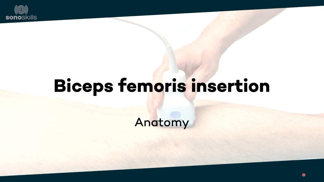 Biceps femoris insertion - anatomy