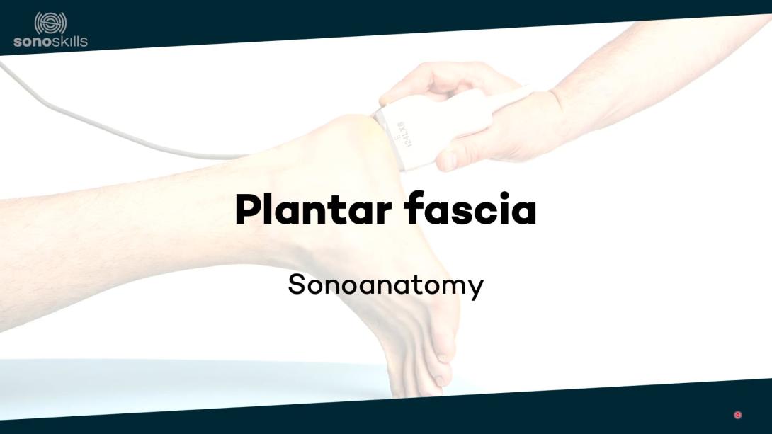 Plantar fascia - sonoanatomy