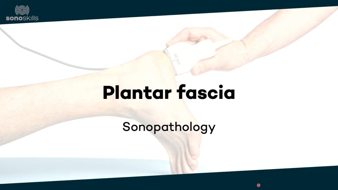 Plantar fascia - sonopathology