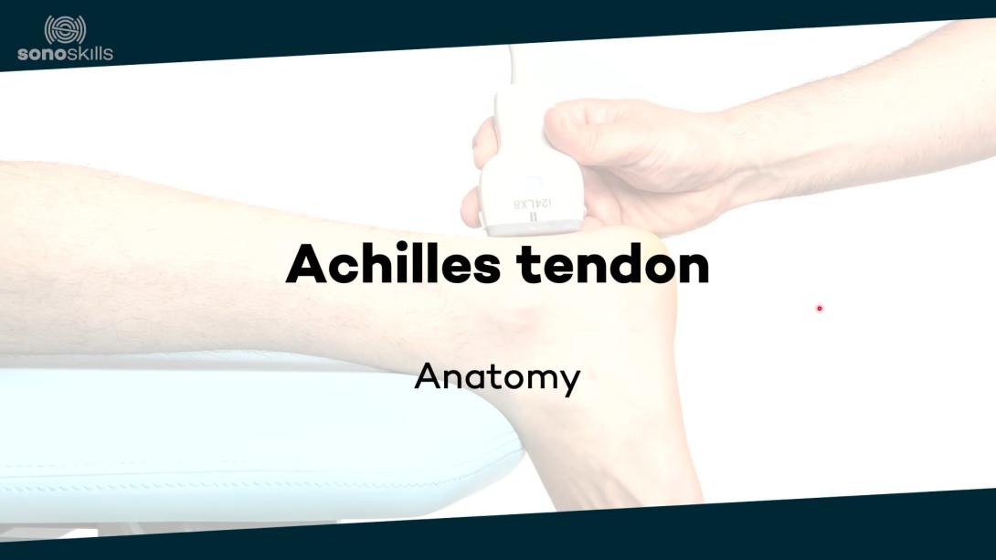 Achilles tendon and calf - anatomy