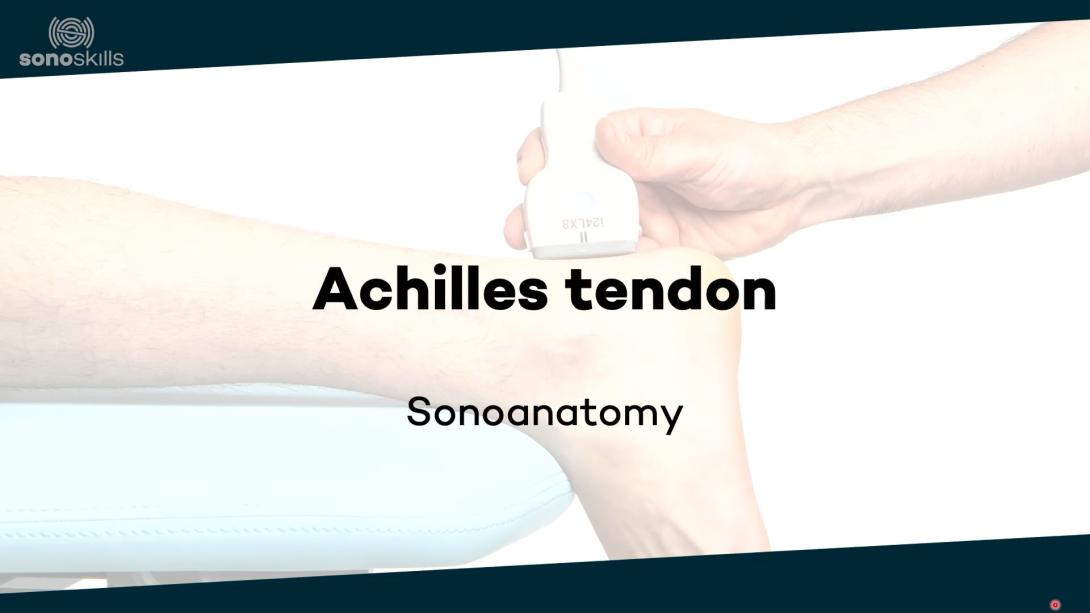 Achilles tendon and calf - sonoanatomy