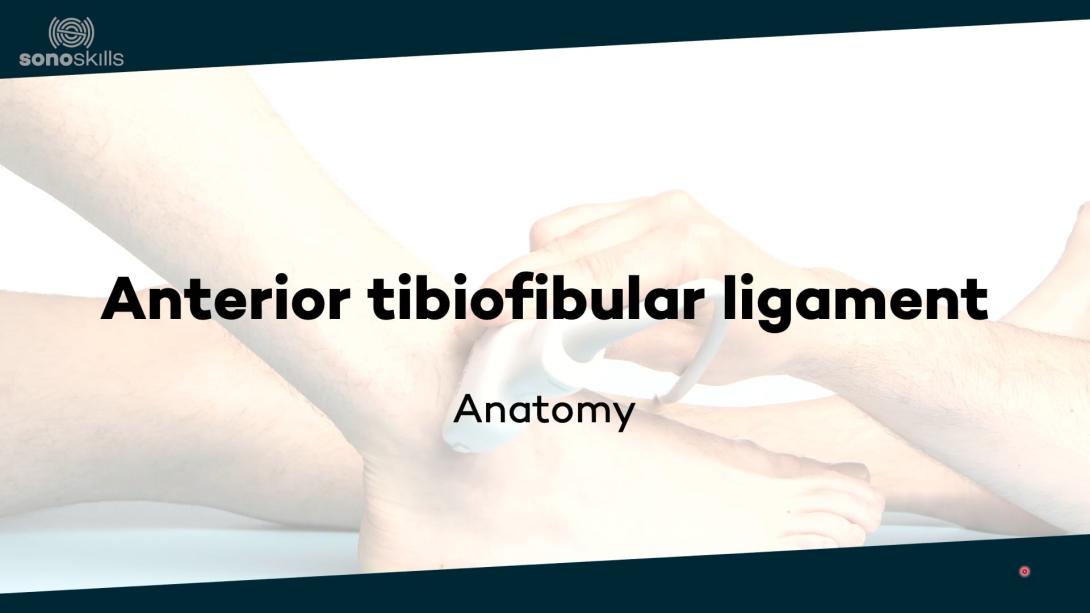 Anterior tibiofibular ligament - anatomy