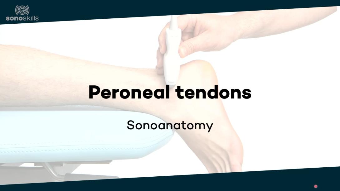 Peroneal tendons - sonoanatomy
