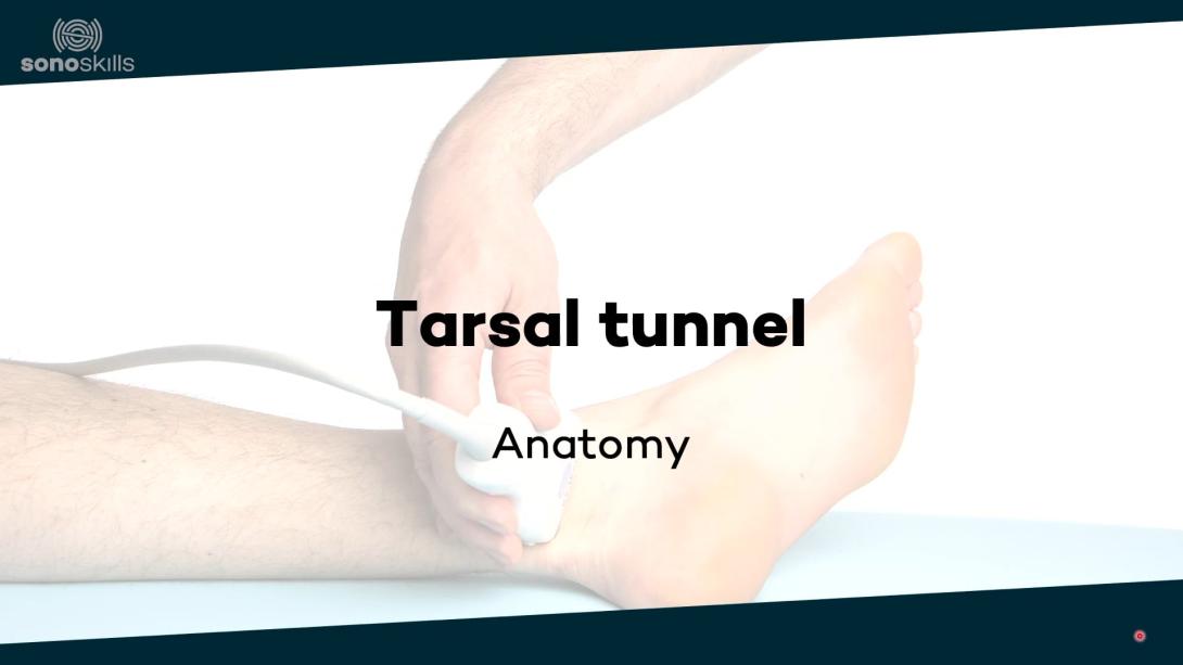 Tarsal tunnel - anatomy