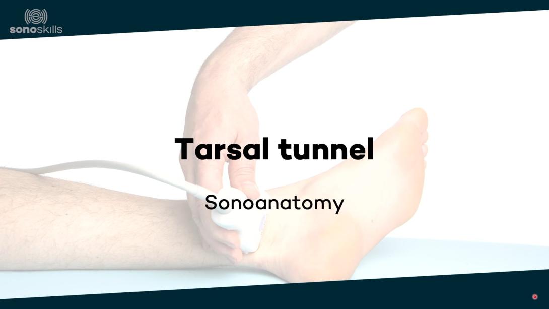 Tarsal tunnel - sonoanatomy