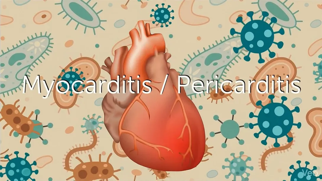 Myopericardial Syndromes - What is the Cause and How Do they Evolve