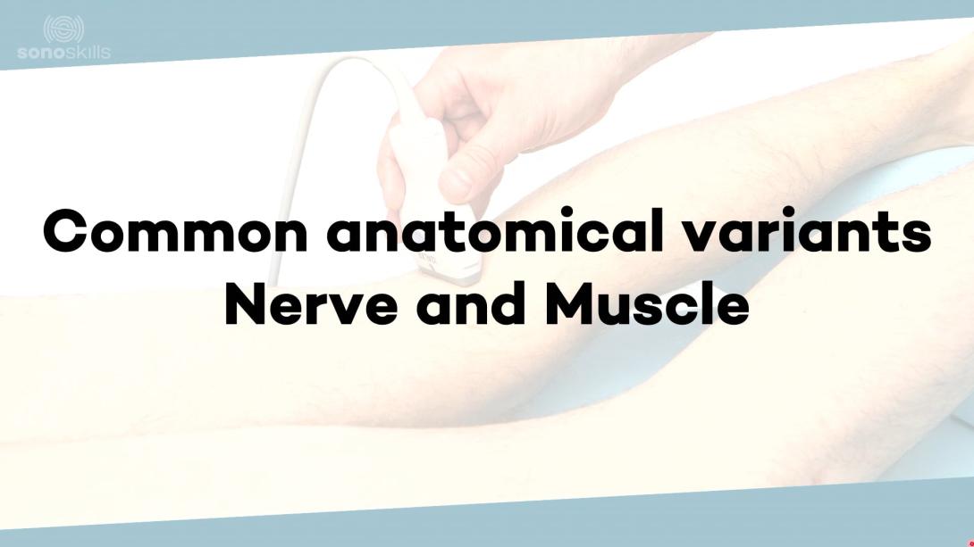 Common variants in nerve and muscle anatomy