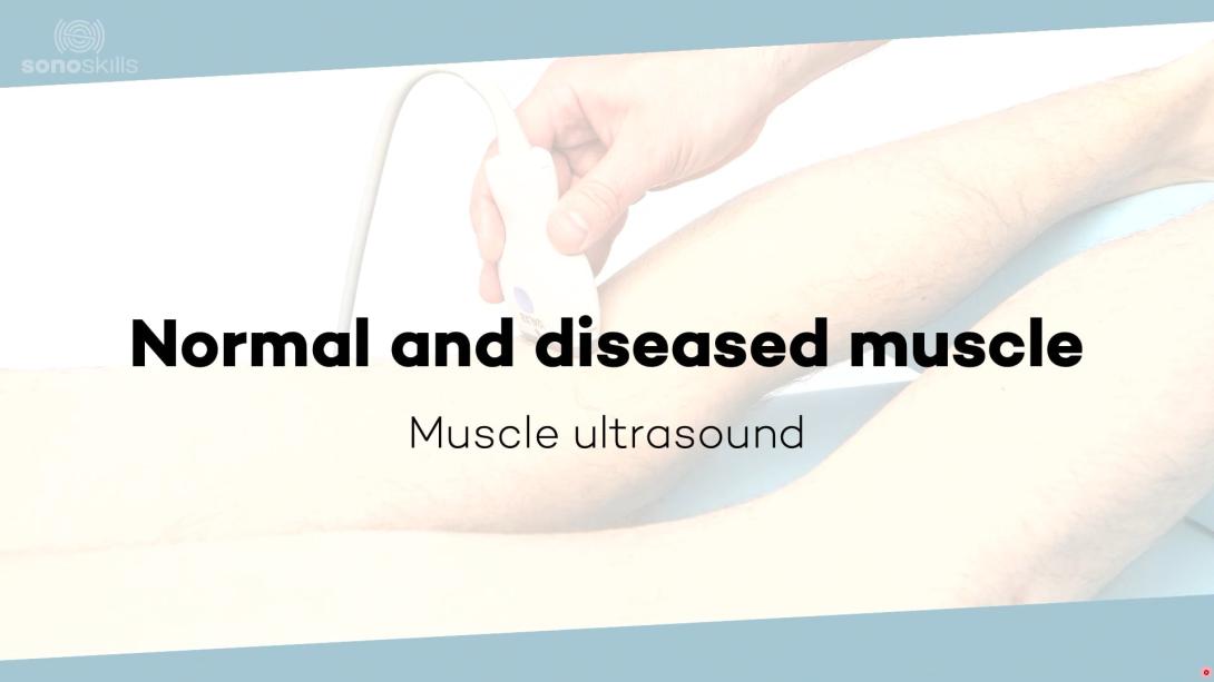 Normal and diseased muscle