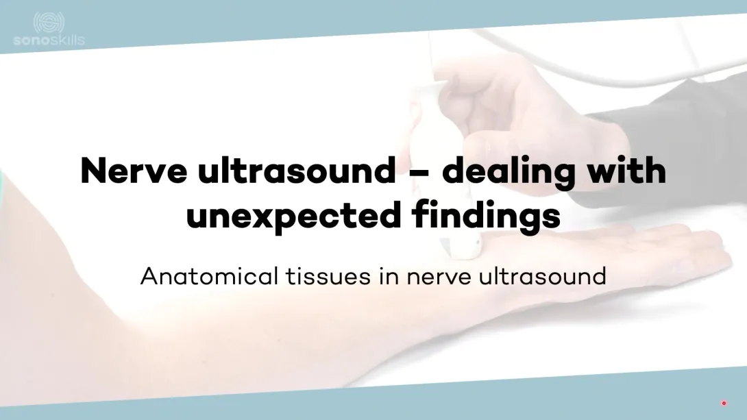 Dealing with unexpected findings