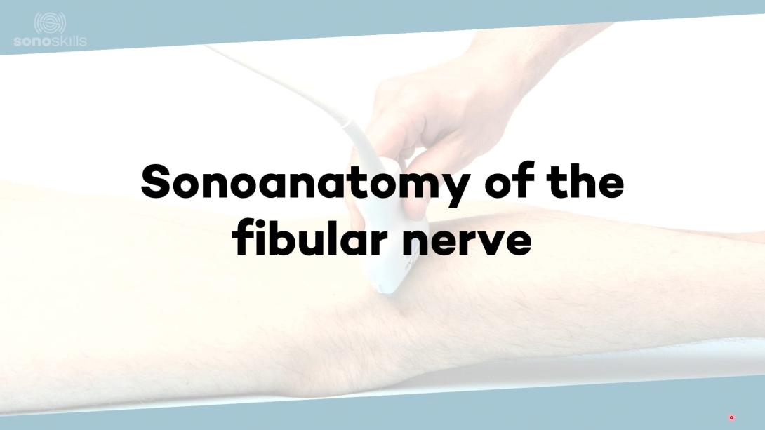 (Sono)anatomy of the fibular nerve