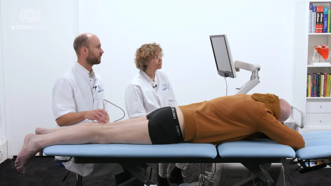 Sonopathology of the fibular nerve - Part 2