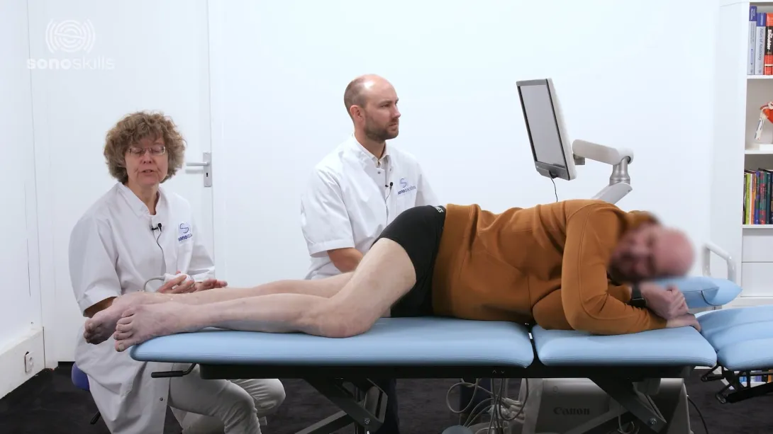Sonopathology of the tibial nerve - Part 2