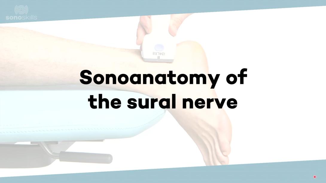 (Sono)anatomy sural nerve
