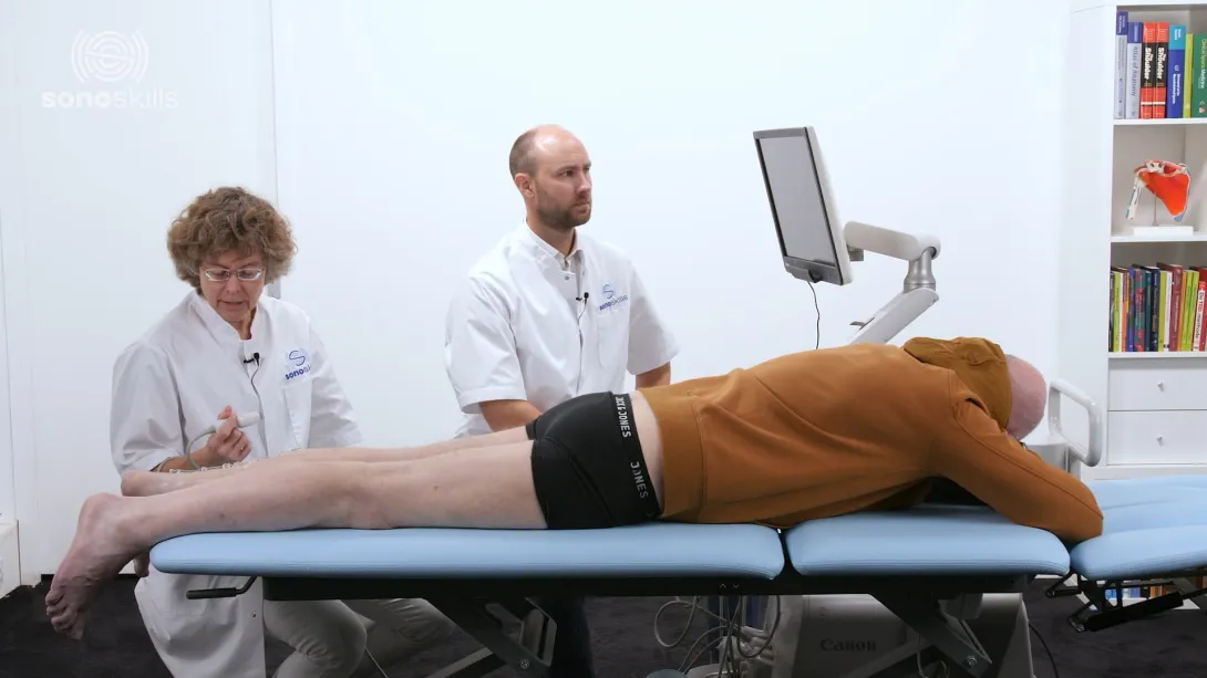 Sonopathology of the sural nerve - Part 2