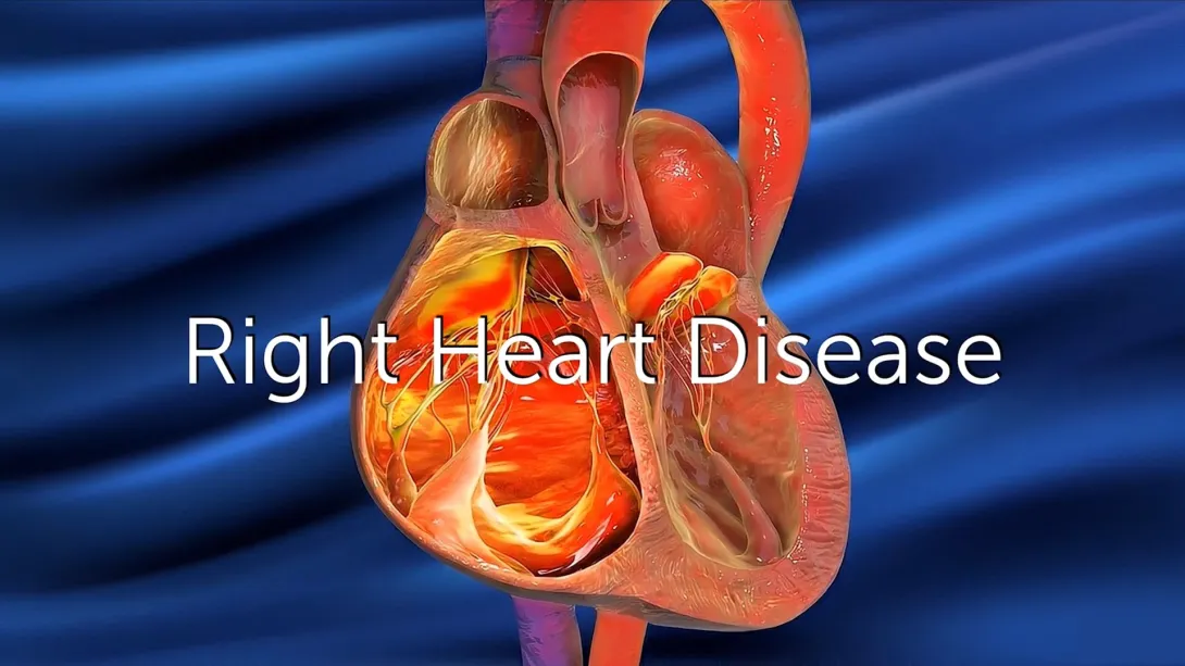 How Do We Screen for Pulmonary Hypertension?