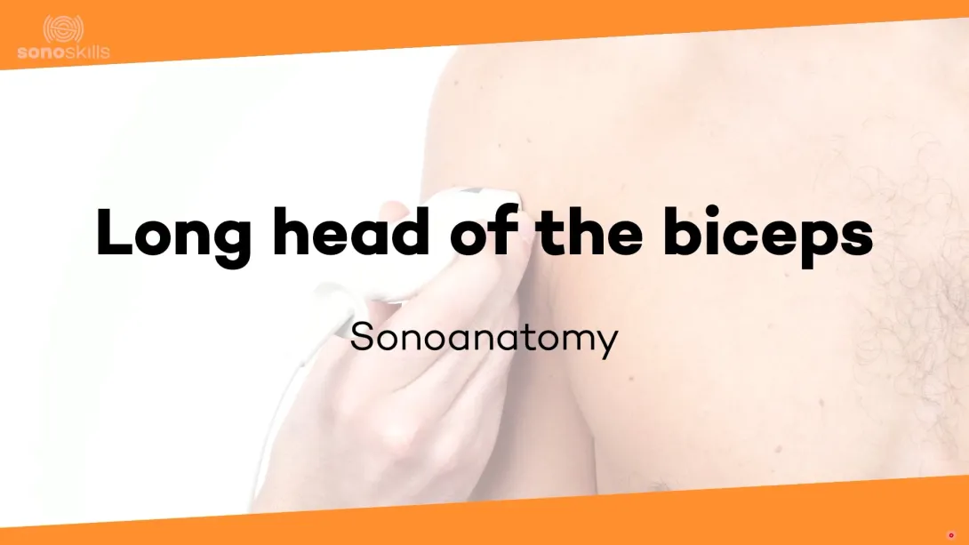 Long head of biceps - sonoanatomy
