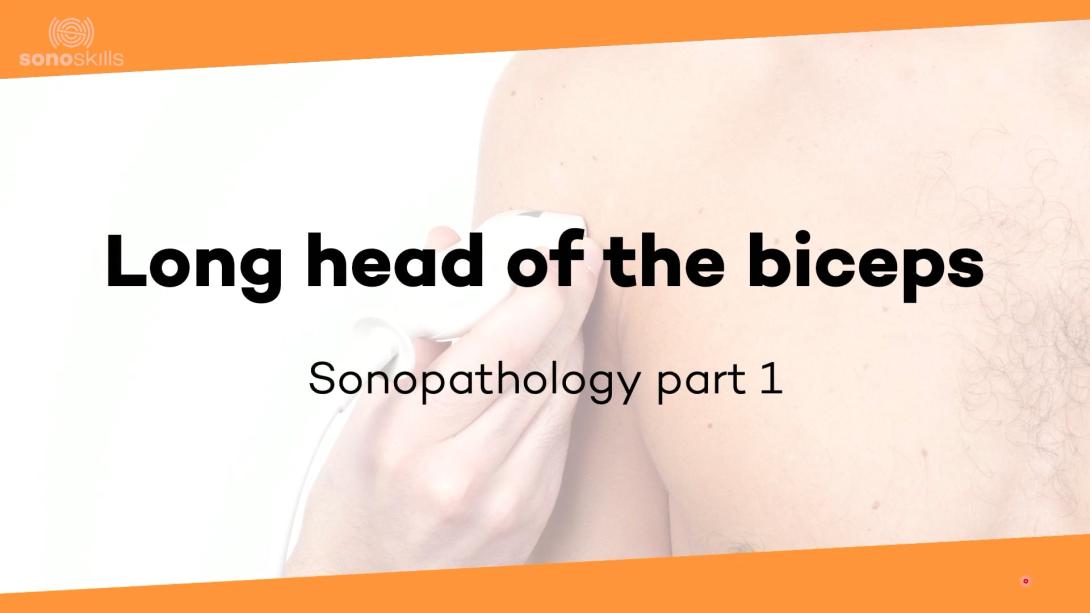 Long head of the biceps tendon part 1 - sonopathology