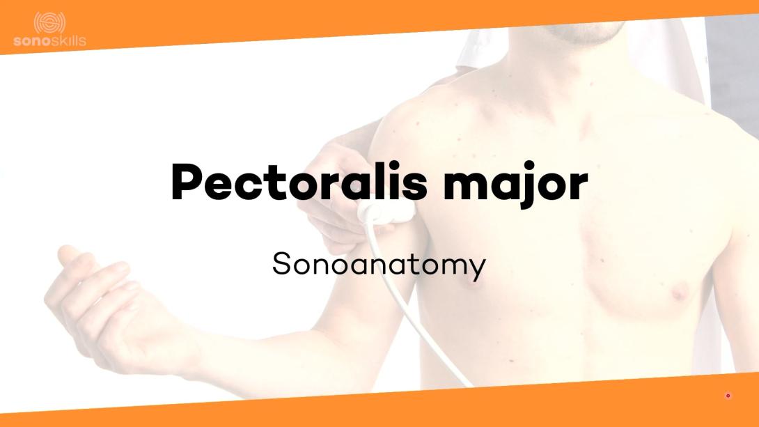 Pectoralis major - sonoanatomy