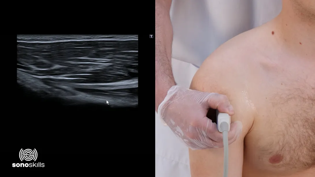 Pectoralis major - hands on SAX