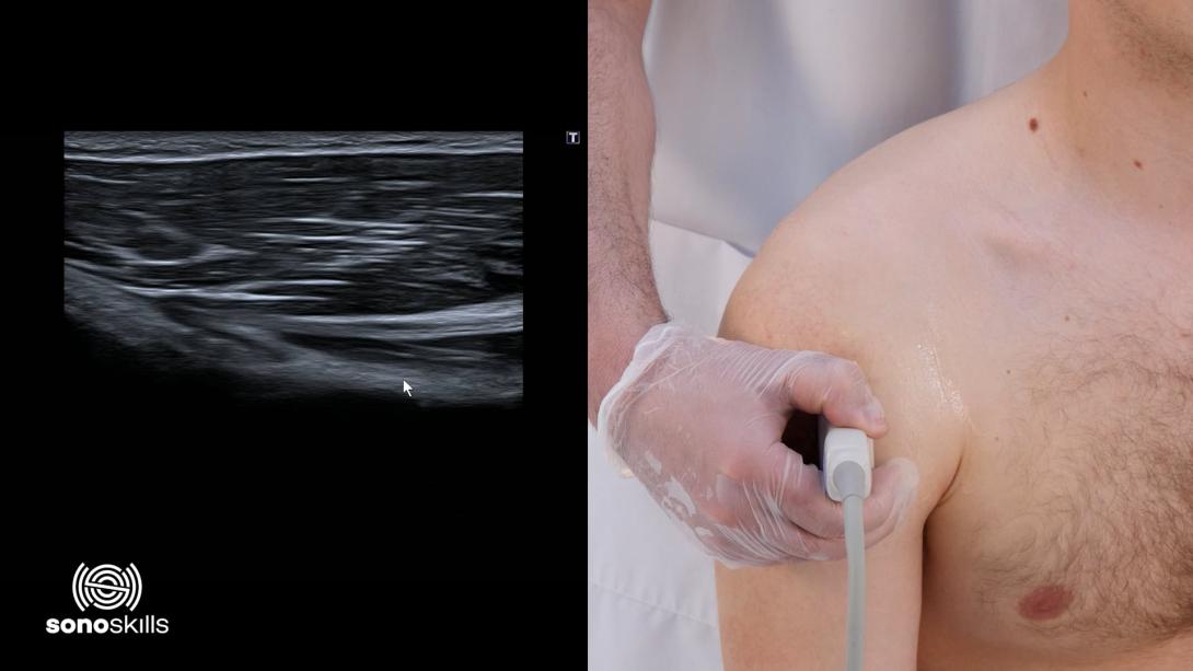 Pectoralis major - hands on SAX
