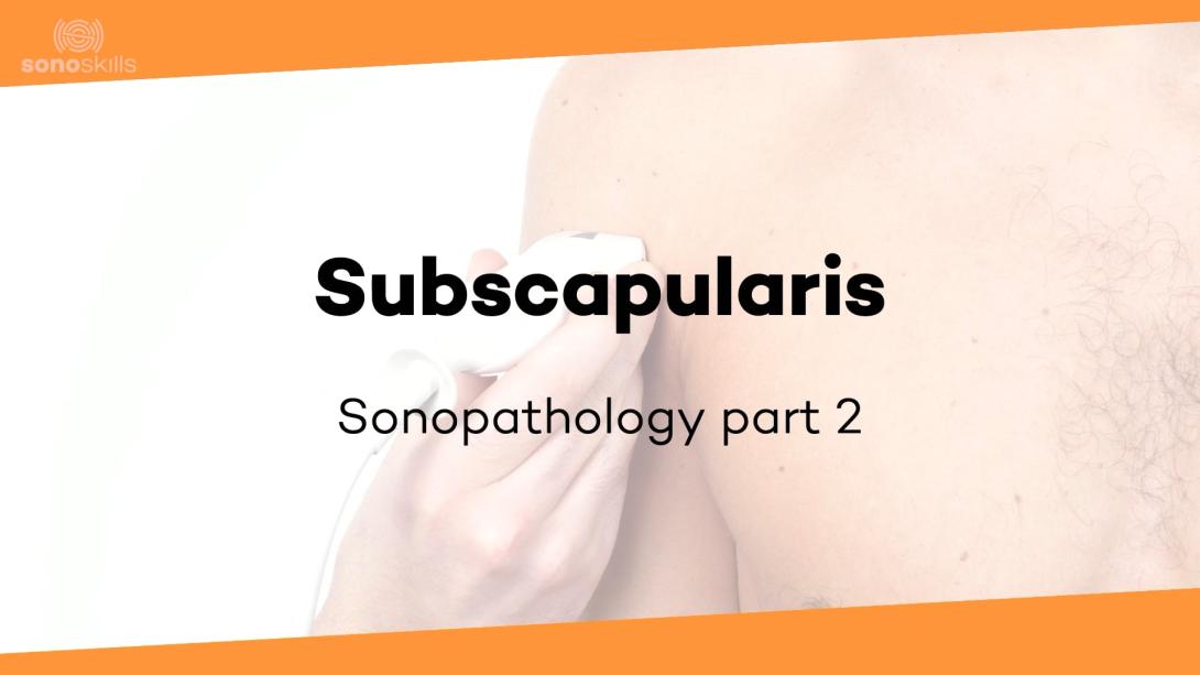 Subscapularis part 2 - sonopathology