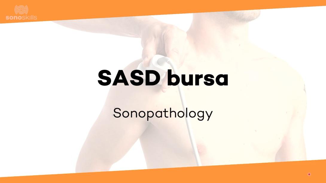 SASD bursa - sonopathology