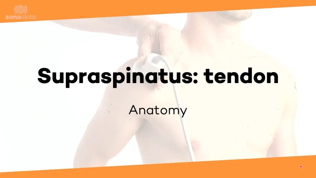 Supraspinatus tendon - anatomy