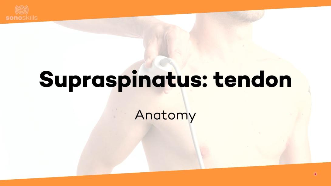 Supraspinatus tendon - anatomy