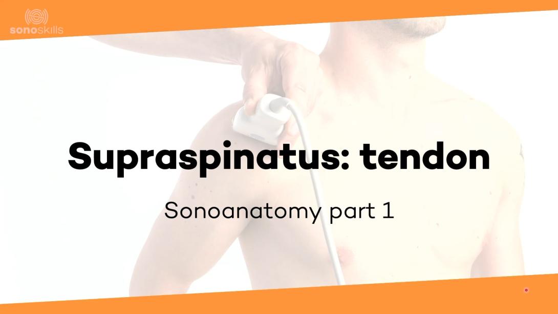 Supraspinatus tendon part 1 - sonoanatomy