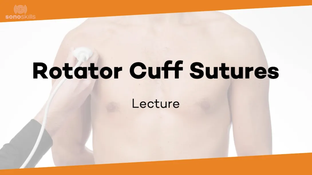 Postoperative cuff  - sonopathology