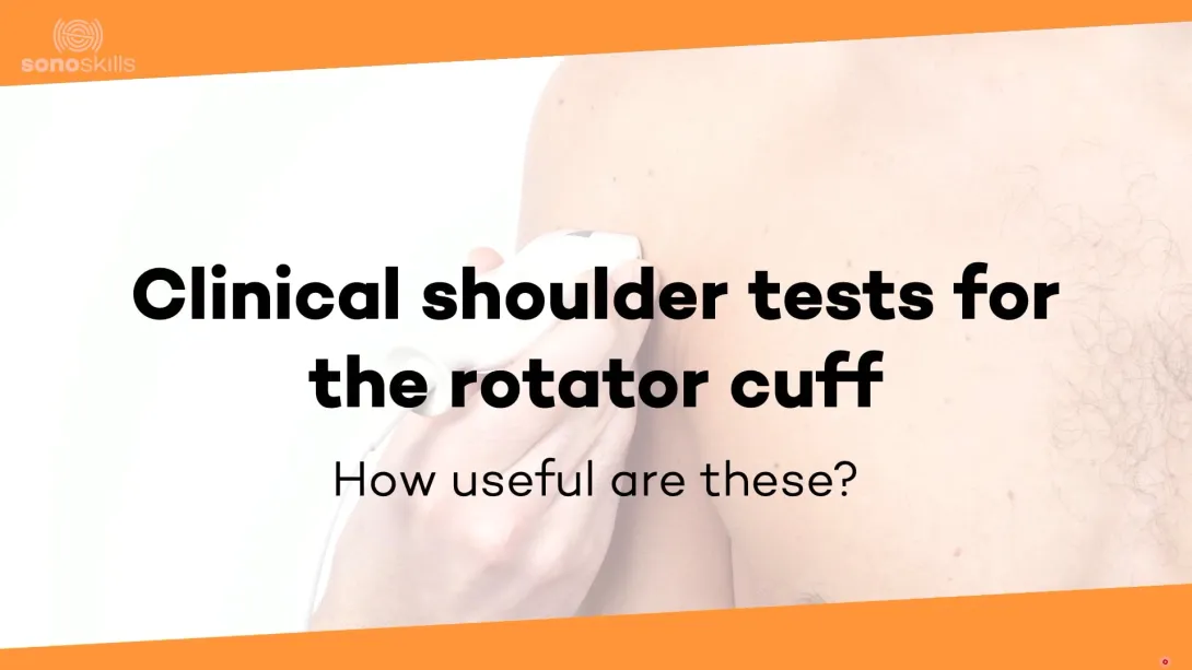 Clinical shoulder tests Rotator cuff