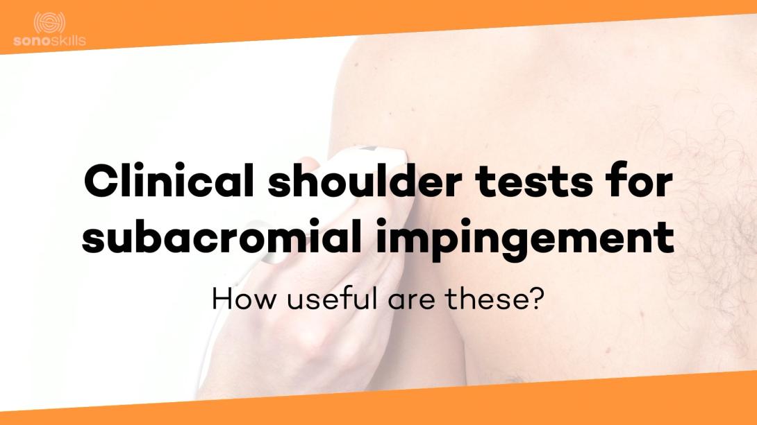 Clinical shoulder tests_subacromial impingement