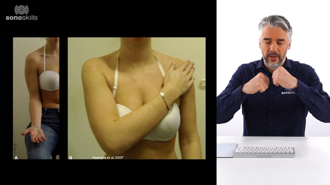 AC / SC / Clavicula sonoanatomy