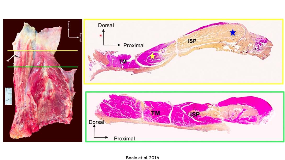 Infraspinatus / teres minor - anatomy