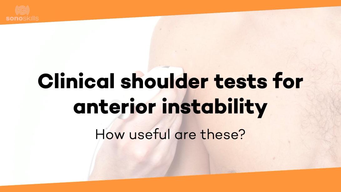 Clinical shoulder tests: Anterior instability