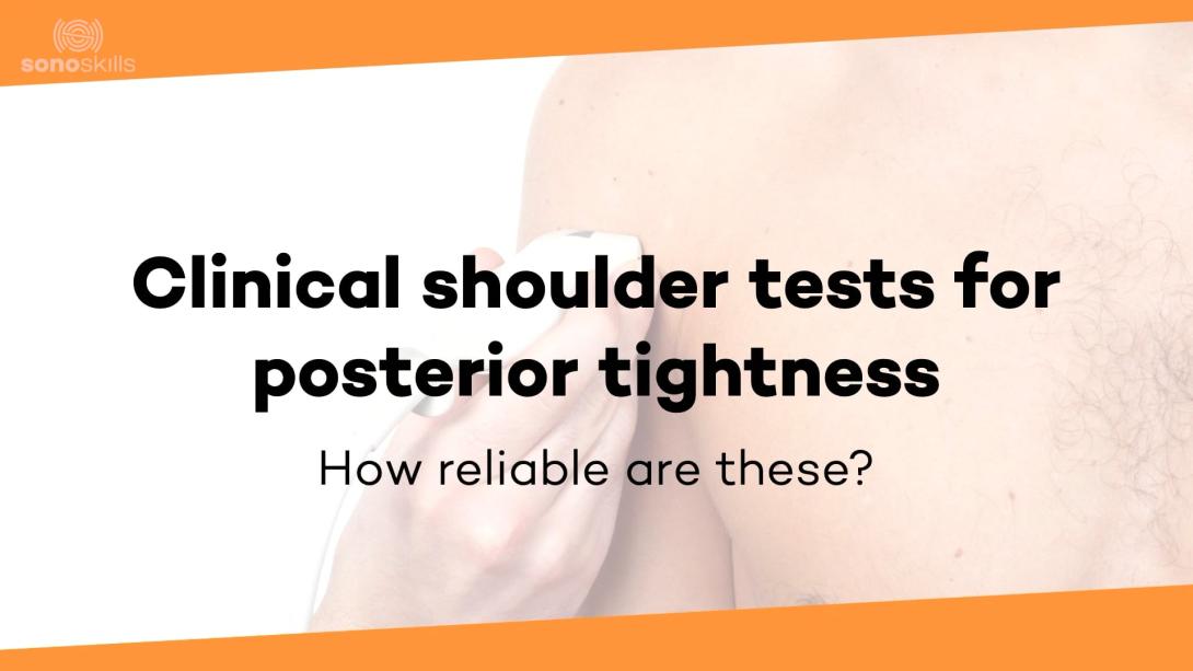Clinical shoulder tests: Posterior tightness
