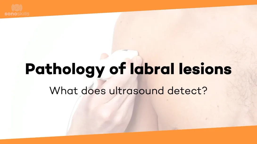 Pathology labrum