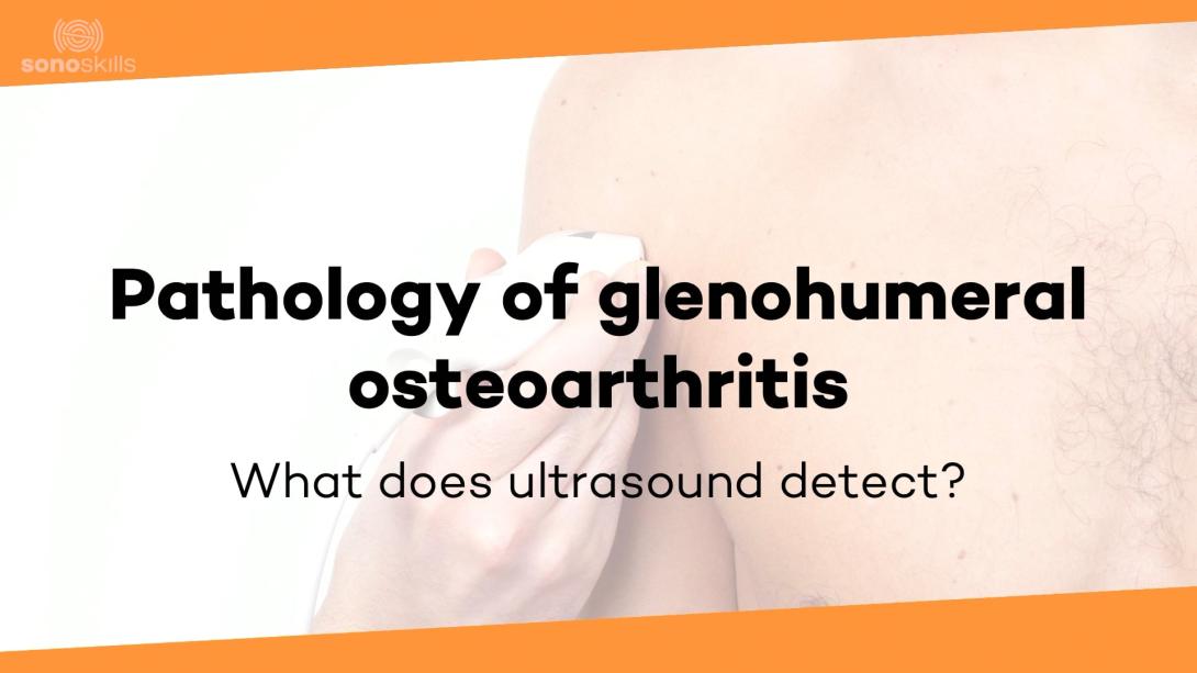 Pathology GH osteoarthritis