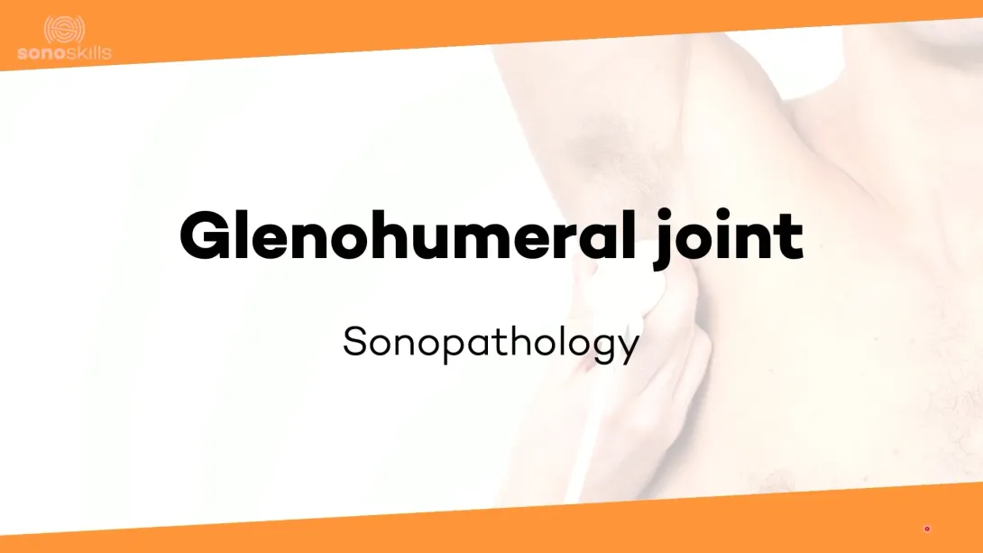 Glenohumeral joint - sonopathology