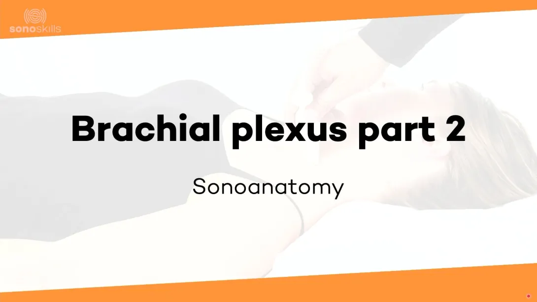 Brachial plexus part 2 - sonoanatomy